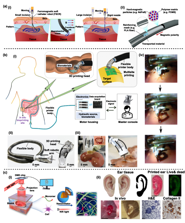 Robotic in situ bioprinting for cartilage tissue engineering - IOPscience