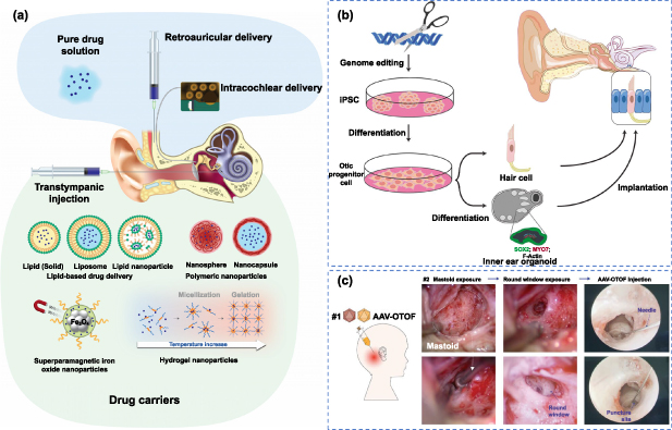 Artificial hearing systems based on functional cochlea models - IOPscience