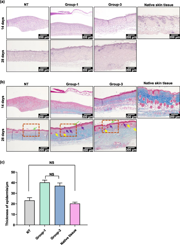 Reet Ridges Bioengineered skin-substitutes incorporating rete-ridges using a ...