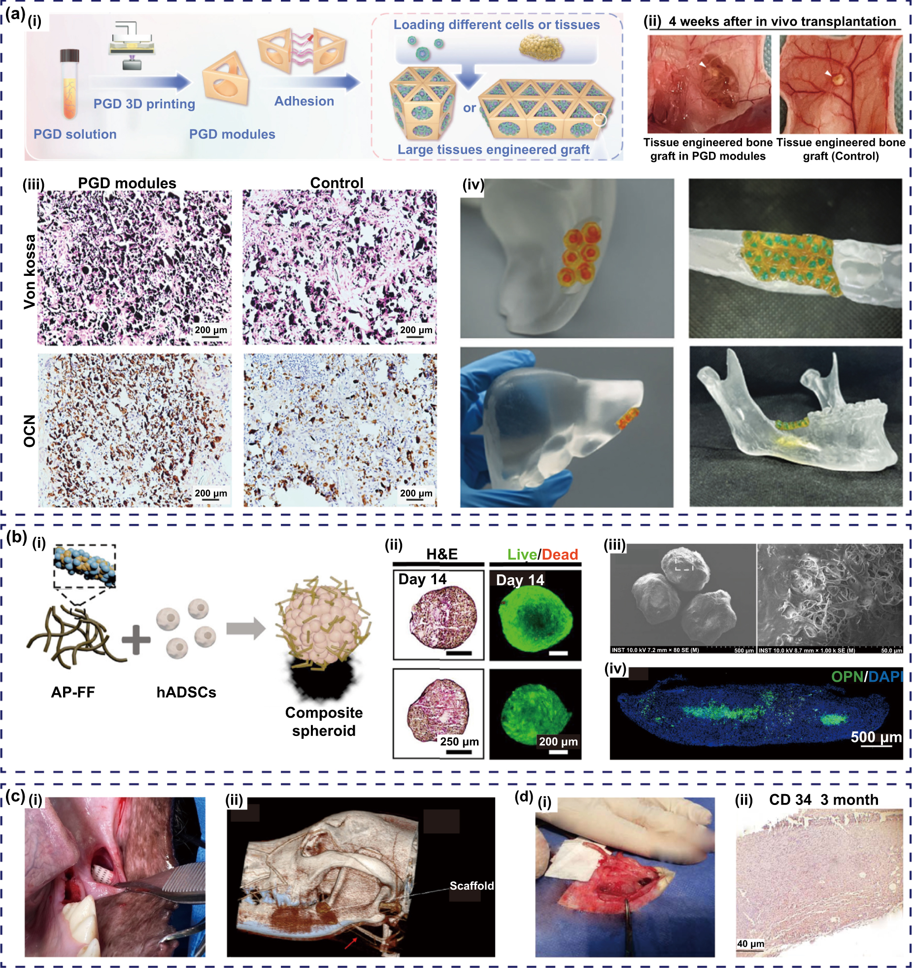 Modular strategy with autologous bioreactor: a potential way for