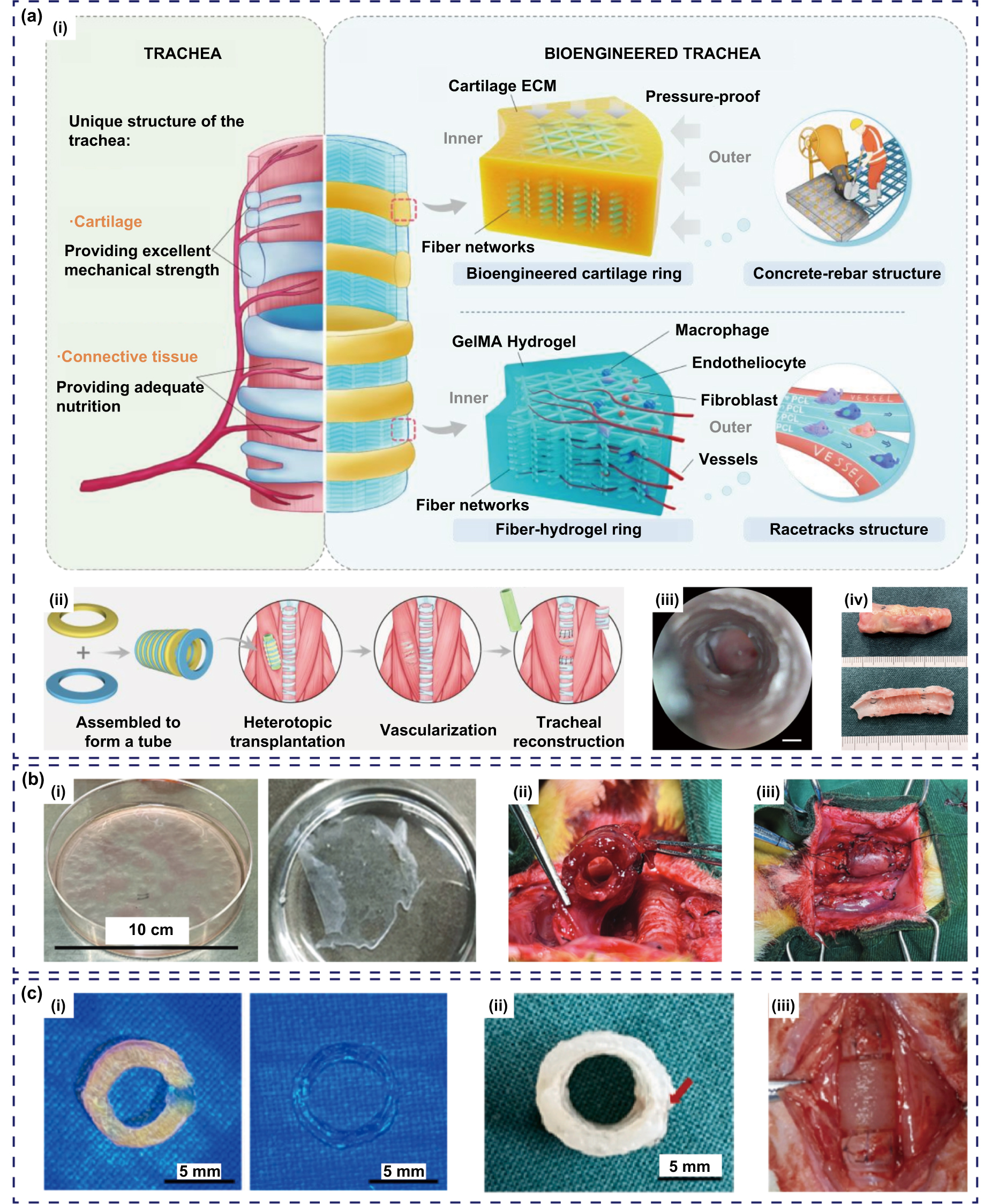 Modular strategy with autologous bioreactor: a potential way for