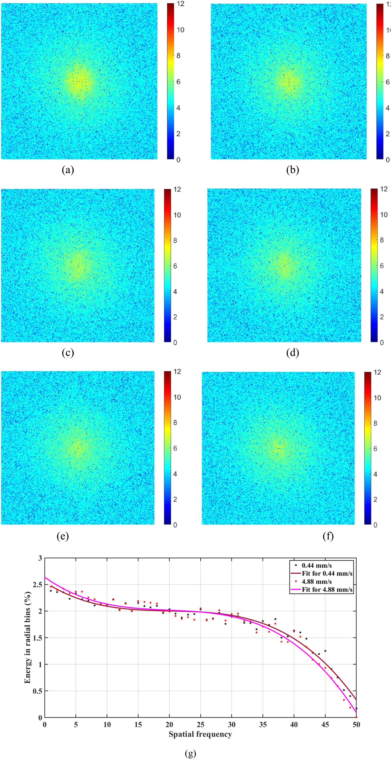 Machine learning integrated laser speckle image analysis for the ...