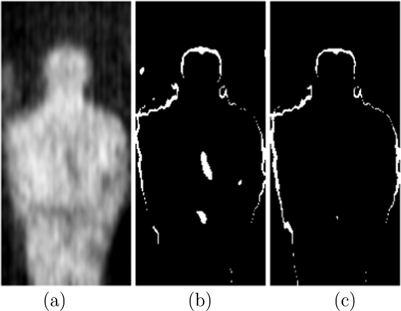 A novel concealed object detection algorithm for entry control and ...