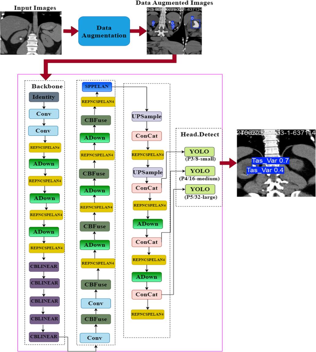Kidney stone detection in CT scans using attention based multi-path ...