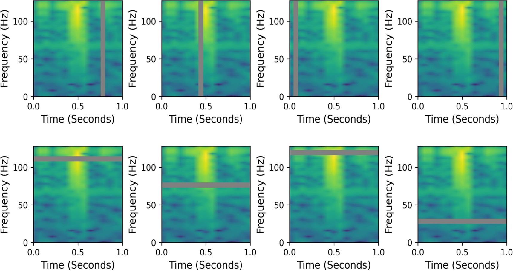 A vision transformer framework for arrhythmia classification with ...
