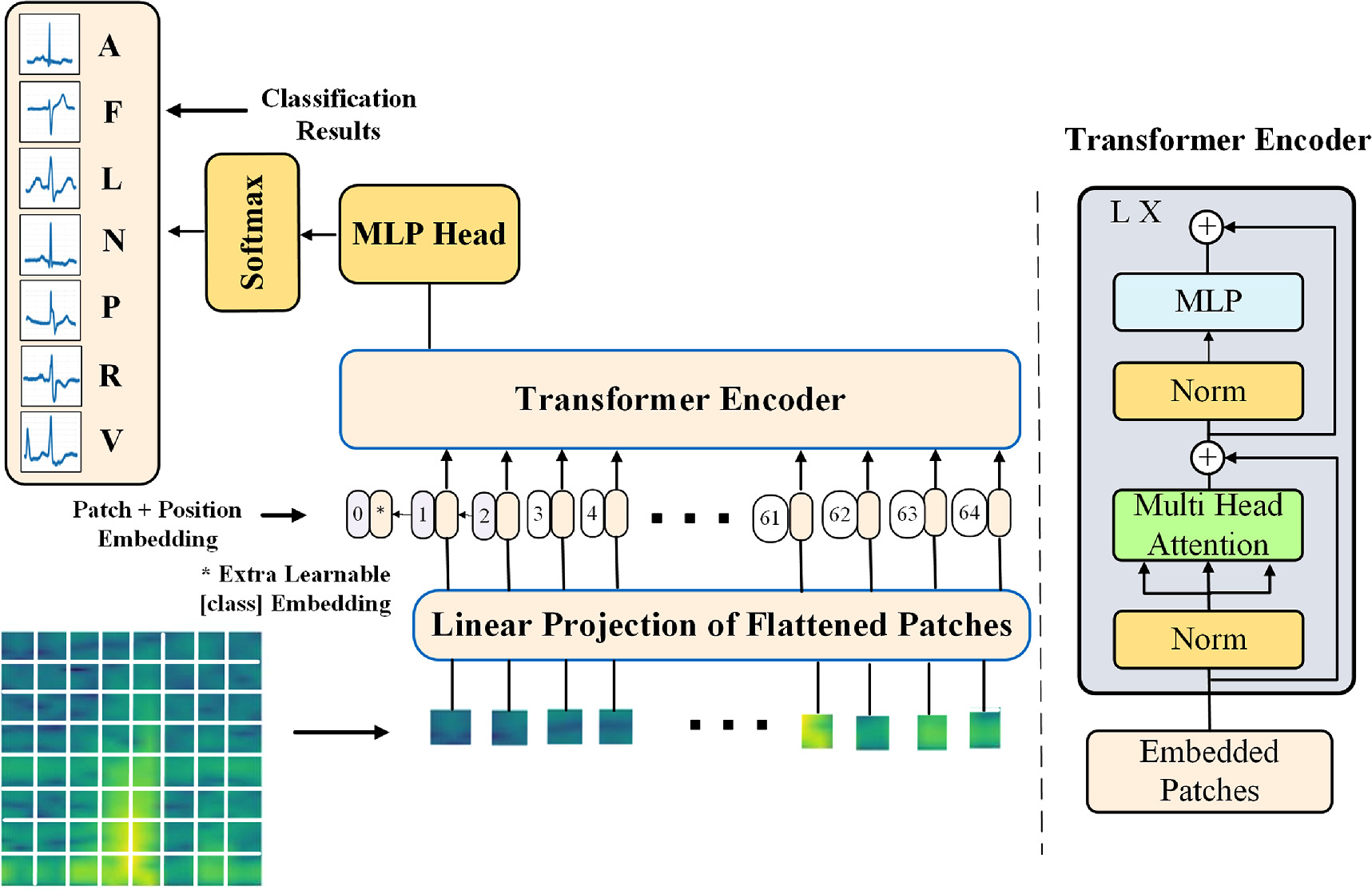 A vision transformer framework for arrhythmia classification with ...