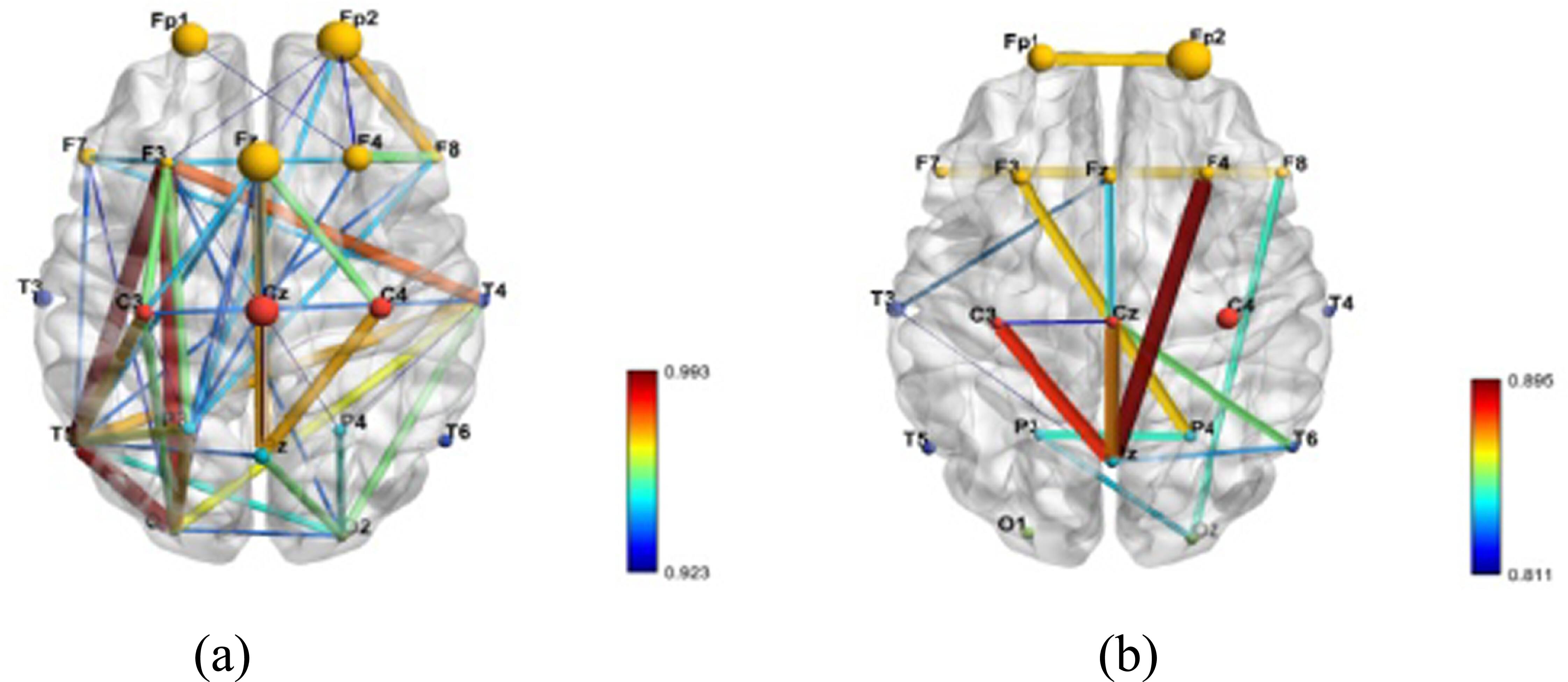 Neural correlates of attention dysfunction in depression, anxiety, and ...