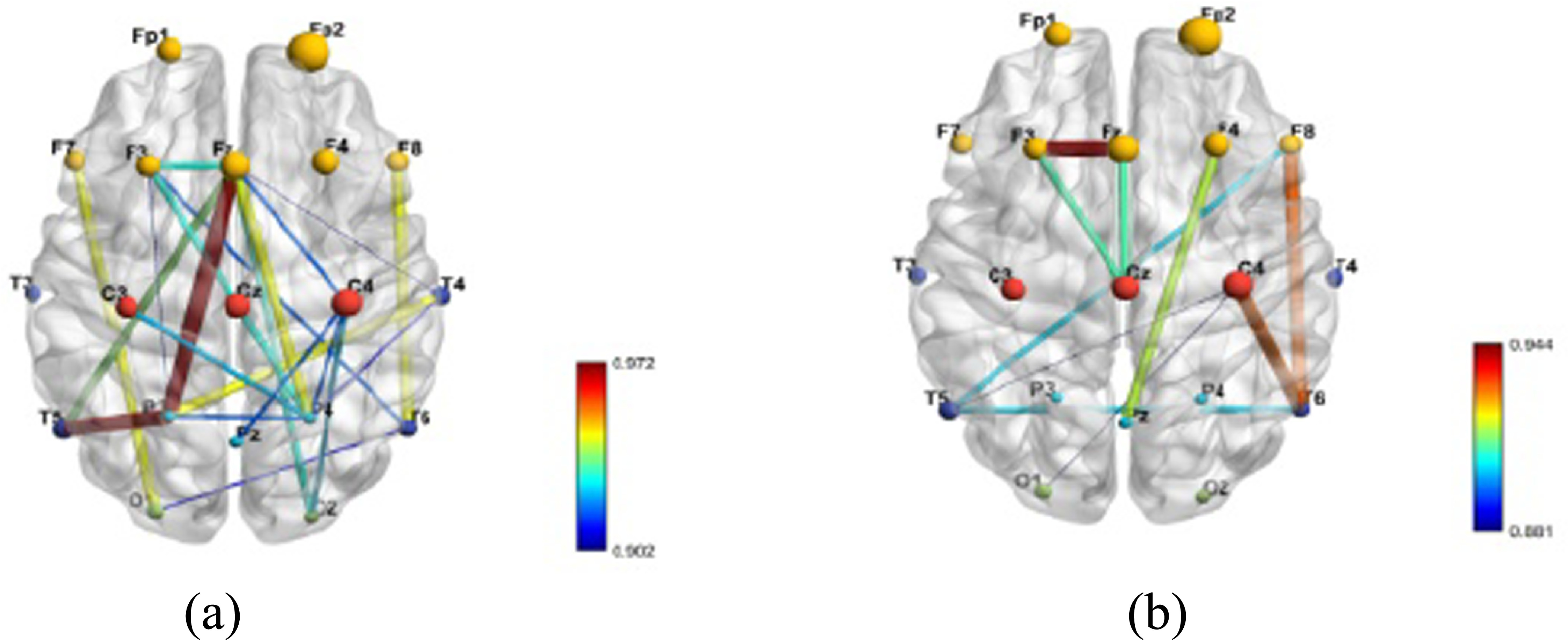 Neural correlates of attention dysfunction in depression, anxiety, and ...