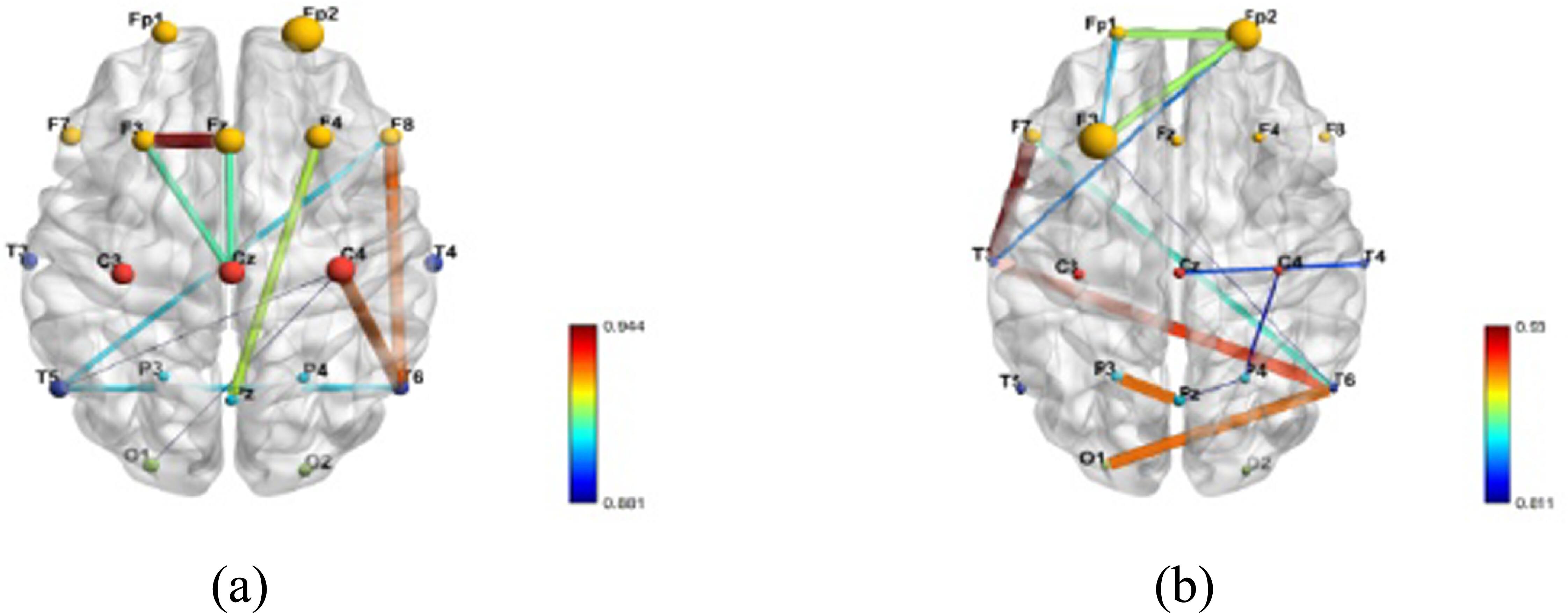 Neural correlates of attention dysfunction in depression, anxiety, and ...