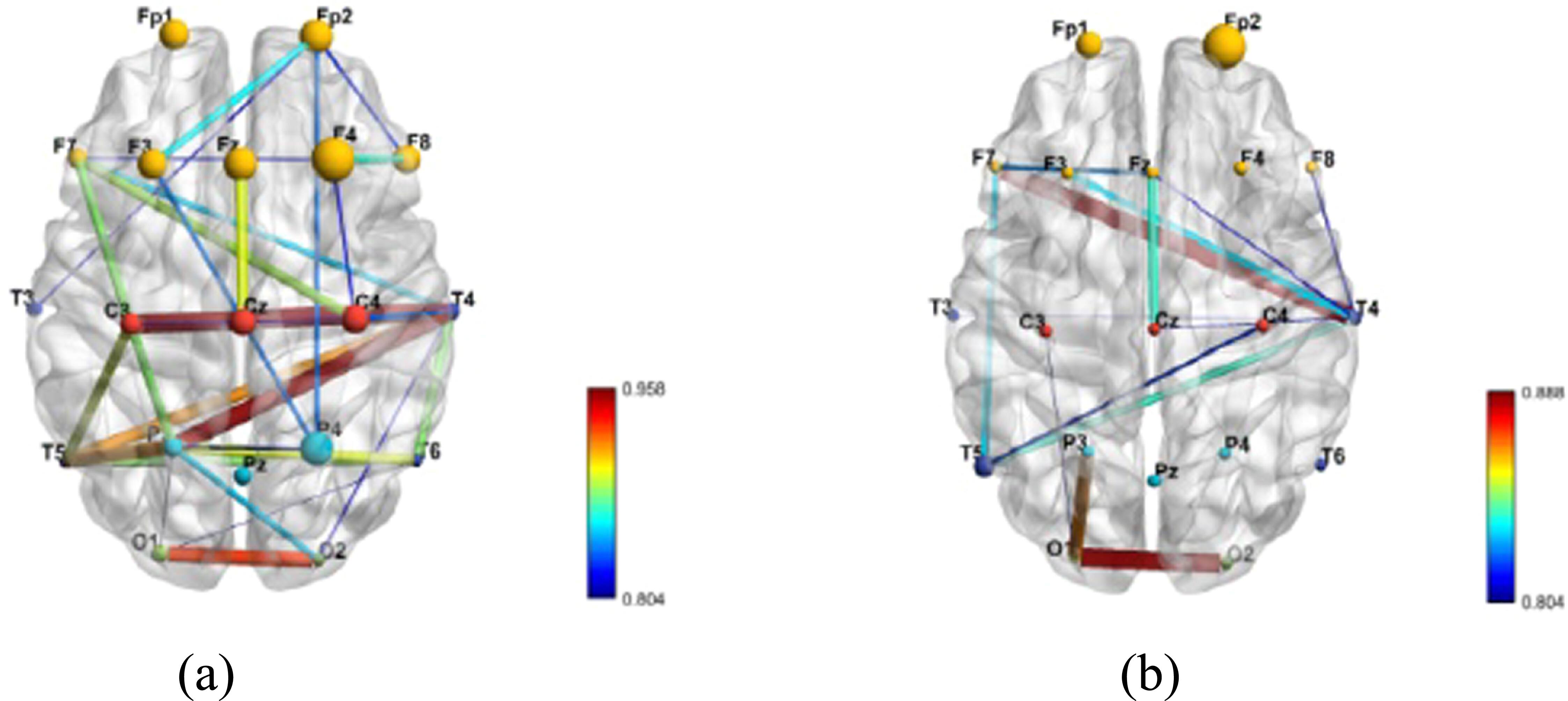 Neural correlates of attention dysfunction in depression, anxiety, and ...