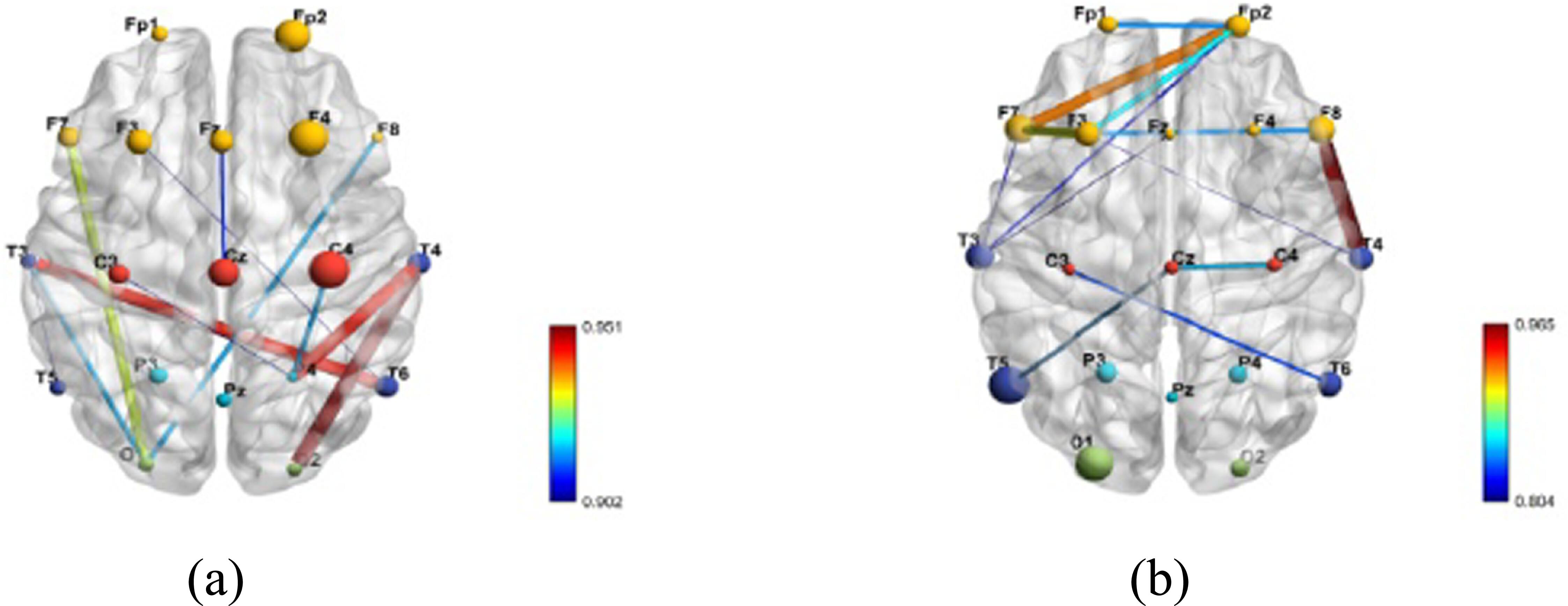 Neural correlates of attention dysfunction in depression, anxiety, and ...