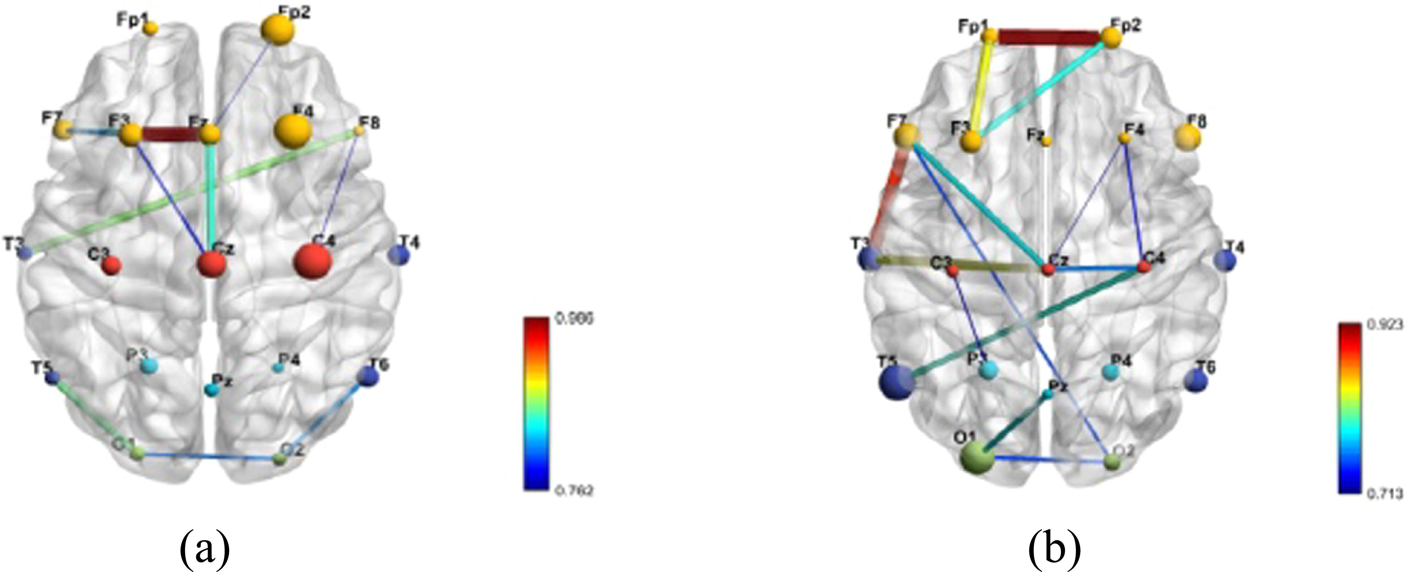 Neural correlates of attention dysfunction in depression, anxiety, and ...