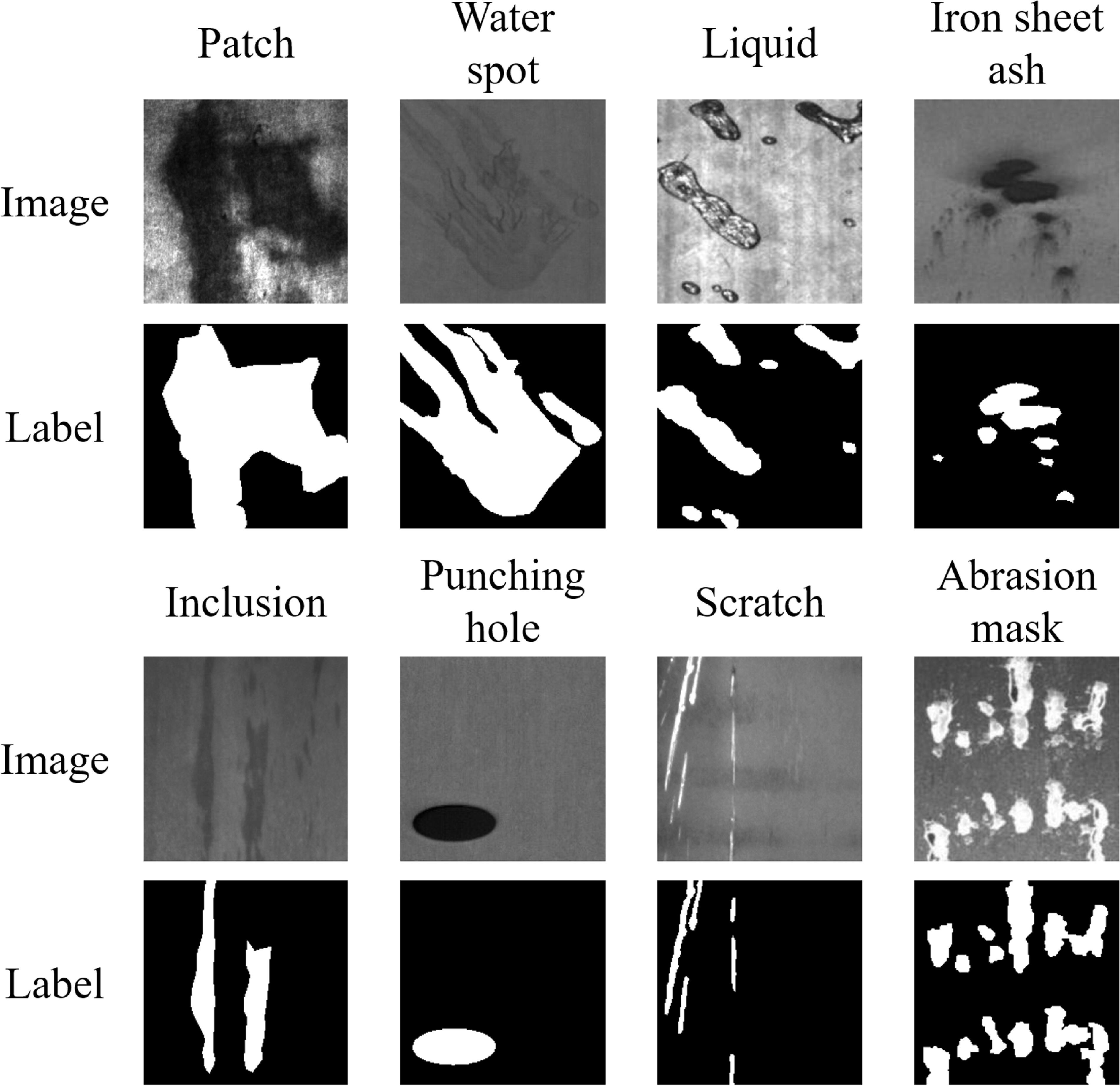 Super-resolution-guided dense enhancement segmentation network for ...