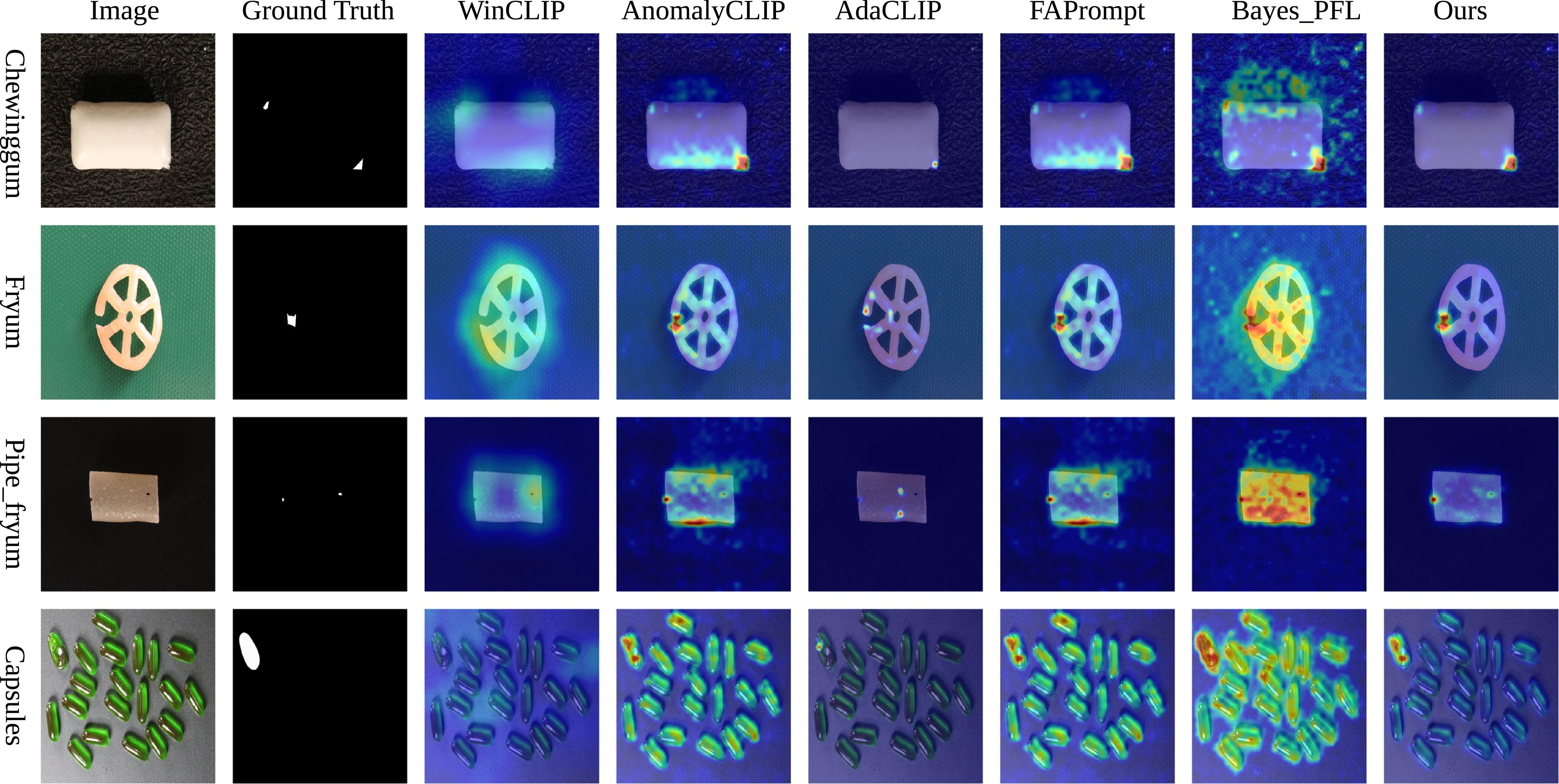 Bidirectional visual-text prompts for zero-shot anomaly detection ...