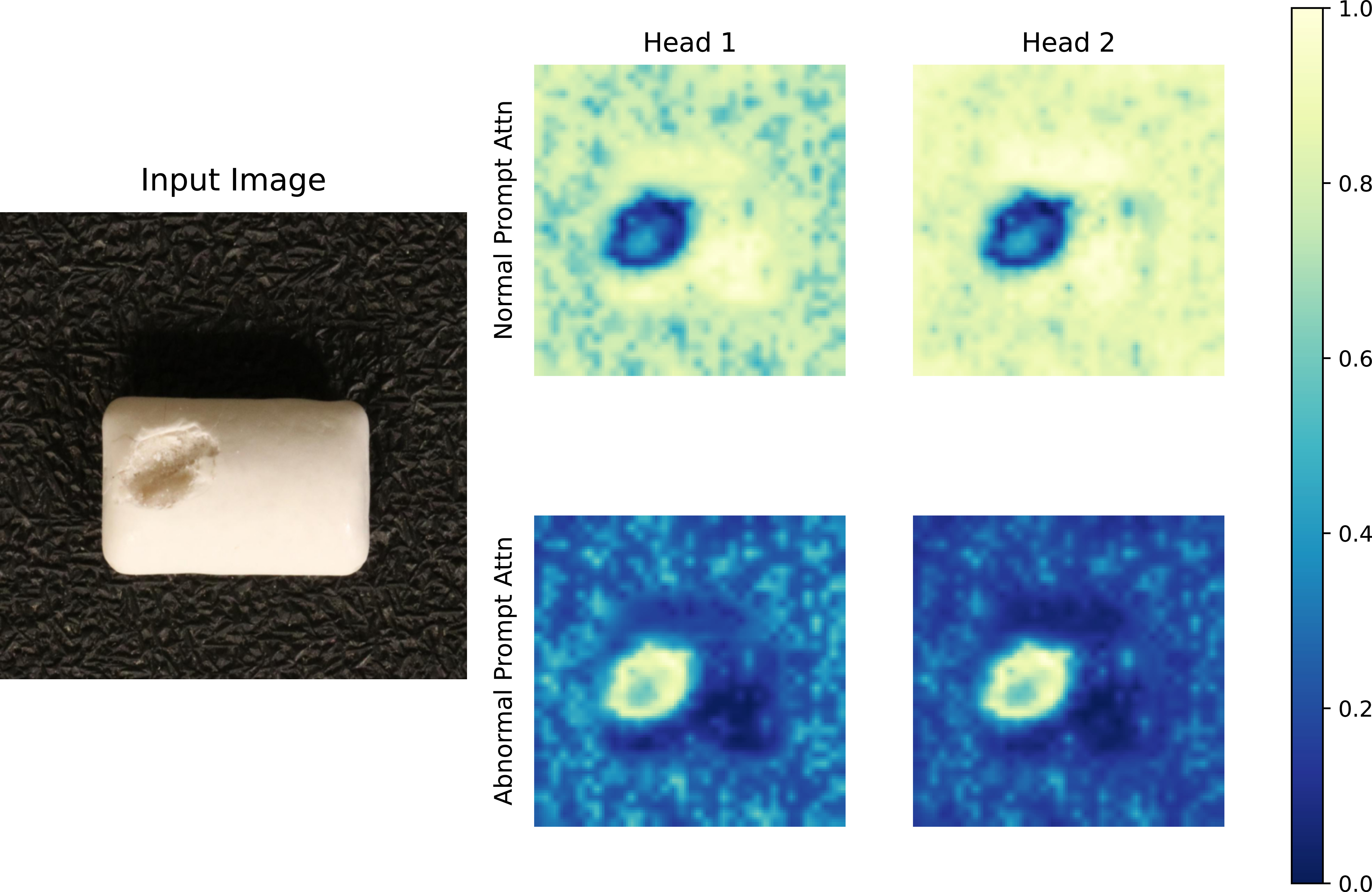 Bidirectional visual-text prompts for zero-shot anomaly detection ...
