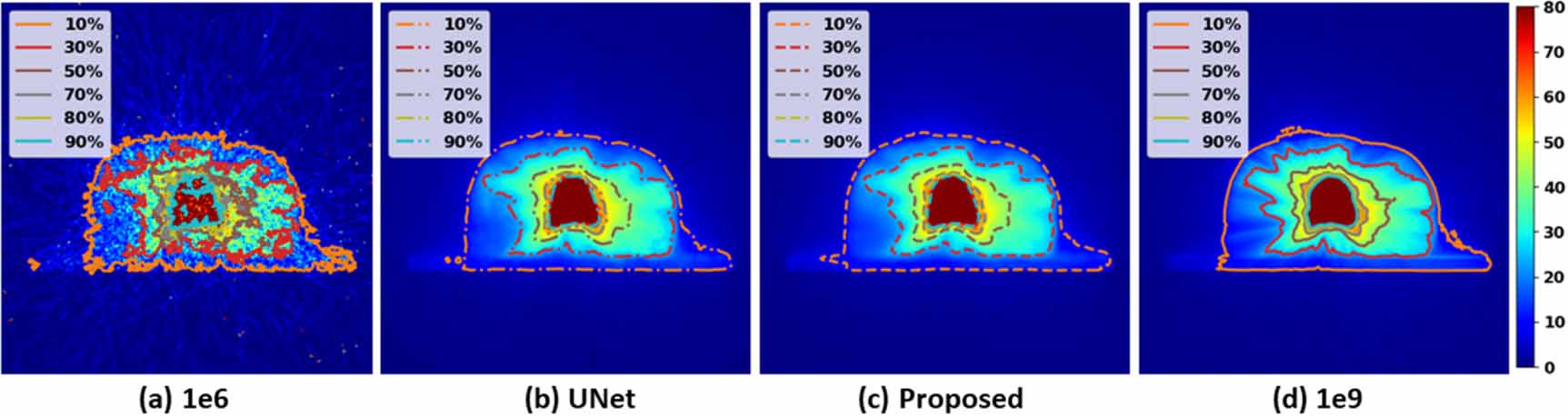 Deep dose plugin: towards real-time Monte Carlo dose calculation ...