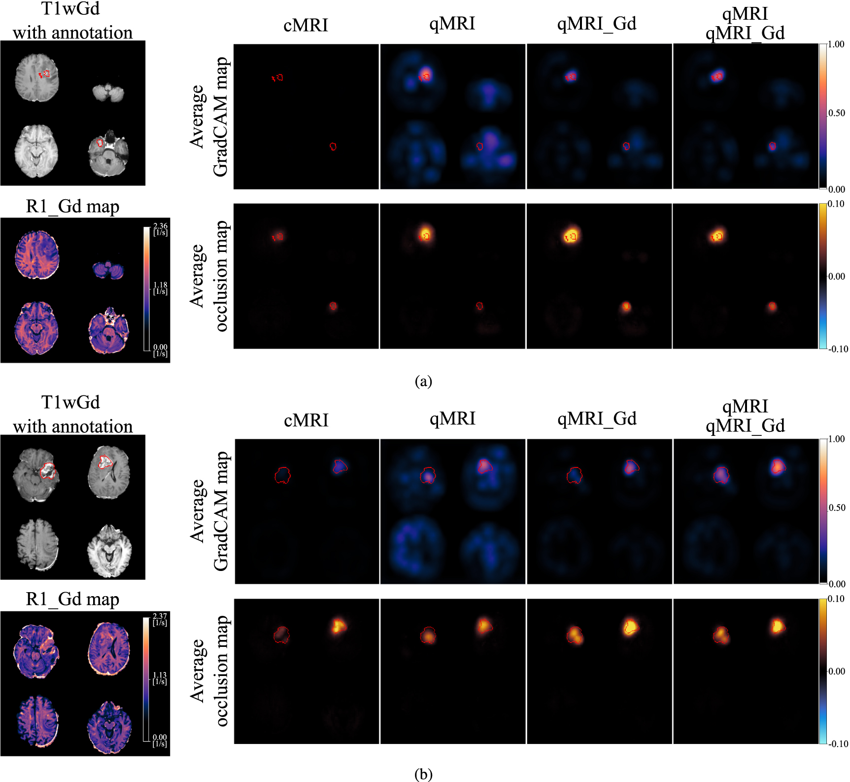 Deep learning-based detection and identification of brain tumor ...