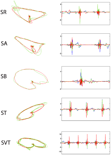 Data-driven dynamics reconstruction using RBF network - IOPscience
