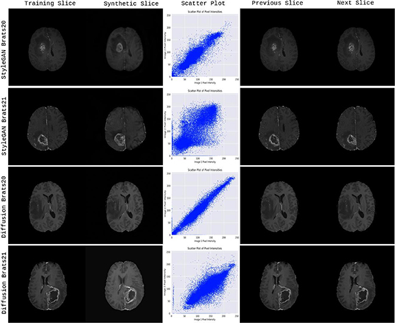Beware of diffusion models for synthesizing medical images—a comparison ...