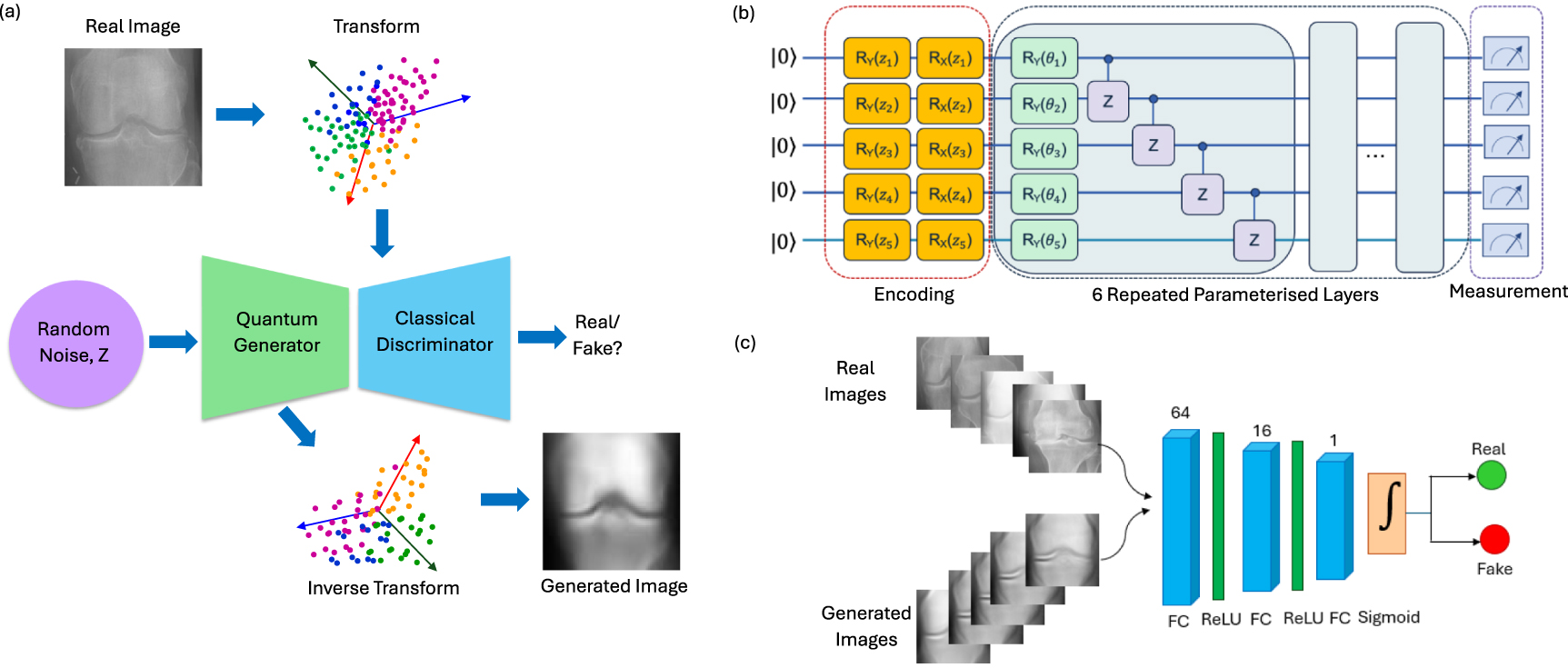 Quantum generative learning for high-resolution medical image ...