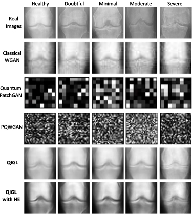 Quantum generative learning for high-resolution medical image ...