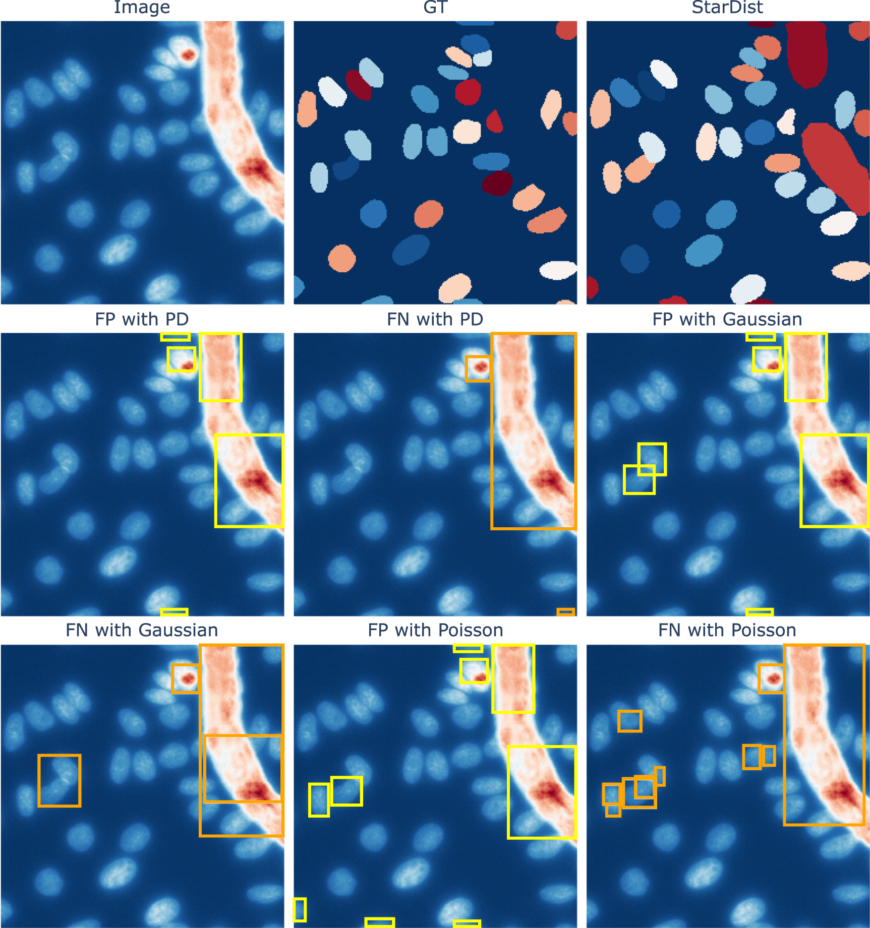 Automated detection of potential artifacts in machine learning based ...