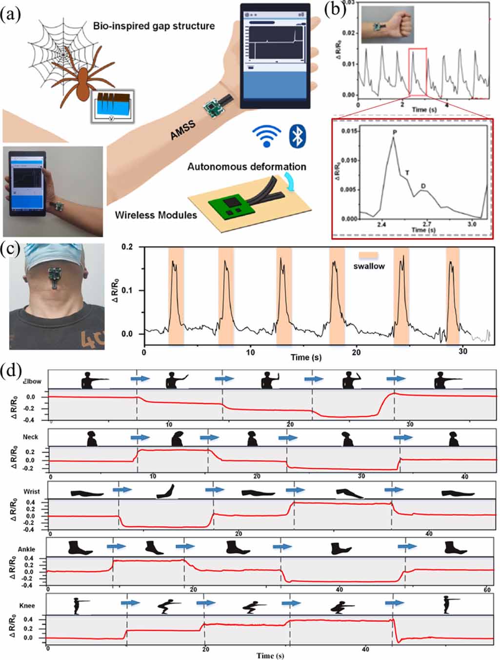 Dynamically customizable 4D printed shape memory polymer biomedical ...