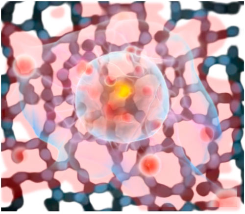 Cancer Biosensing Using Plasmonic Metal Doped Graphene-Based Materials