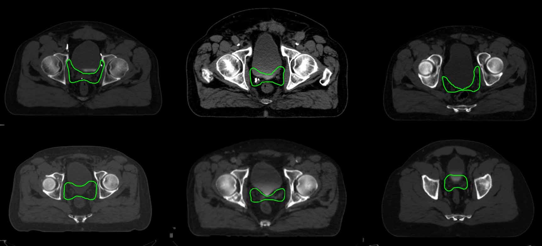 Incorporating physicians’ contouring style into auto-segmentation of ...