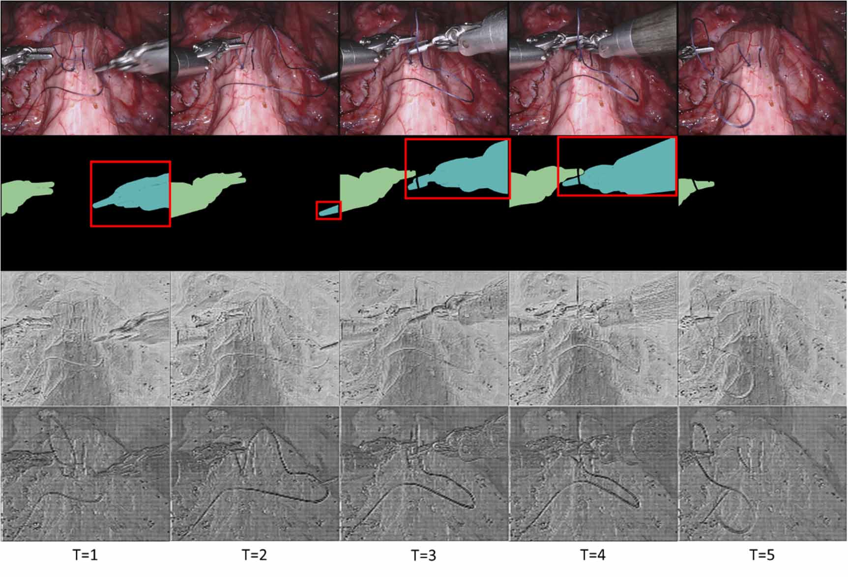 TSMS-SAM2: multi-scale temporal sampling augmentation and memory ...
